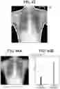 Fig. 29 - RADIATION IMAGING SYSTEM