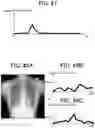Fig. 30 - RADIATION IMAGING SYSTEM