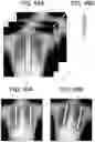 Fig. 31 - RADIATION IMAGING SYSTEM