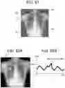 Fig. 32 - RADIATION IMAGING SYSTEM