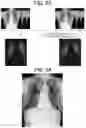 Fig. 33 - RADIATION IMAGING SYSTEM