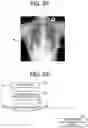 Fig. 34 - RADIATION IMAGING SYSTEM