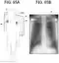 Fig. 41 - RADIATION IMAGING SYSTEM