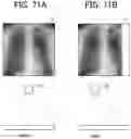 Fig. 45 - RADIATION IMAGING SYSTEM