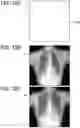 Fig. 46 - RADIATION IMAGING SYSTEM