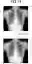 Fig. 47 - RADIATION IMAGING SYSTEM