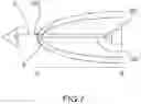 Fig. 09 - Apparatus and methods for alignment and deployment of intracardiac devices