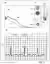 Fig. 08 - APPARATUS AND METHOD FOR ENDOVASCULAR DEVICE GUIDING AND POSITIONING USING PHYSIOLOGICAL PARAMETERS