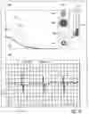 Fig. 10 - APPARATUS AND METHOD FOR ENDOVASCULAR DEVICE GUIDING AND POSITIONING USING PHYSIOLOGICAL PARAMETERS