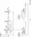 Fig. 11 - APPARATUS AND METHOD FOR ENDOVASCULAR DEVICE GUIDING AND POSITIONING USING PHYSIOLOGICAL PARAMETERS