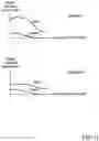 Fig. 12 - APPARATUS AND METHOD FOR ENDOVASCULAR DEVICE GUIDING AND POSITIONING USING PHYSIOLOGICAL PARAMETERS