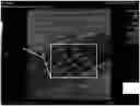 Fig. 01 - ANGLES FOR ULTRASOUND-BASED SHEAR WAVE IMAGING