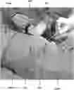 Fig. 01 - Method for obtaining sterile human amniotic fluid and uses thereof