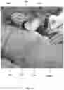 Fig. 02 - Method for obtaining sterile human amniotic fluid and uses thereof