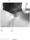 Fig. 03 - Method for obtaining sterile human amniotic fluid and uses thereof