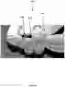 Fig. 04 - Method for obtaining sterile human amniotic fluid and uses thereof