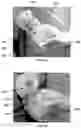 Fig. 06 - Method for obtaining sterile human amniotic fluid and uses thereof