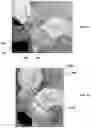 Fig. 07 - Method for obtaining sterile human amniotic fluid and uses thereof