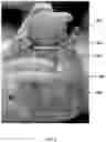 Fig. 09 - Method for obtaining sterile human amniotic fluid and uses thereof