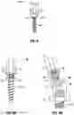 Fig. 04 - Minimally open interbody access retraction device and surgical method