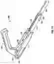 Fig. 16 - Minimally open interbody access retraction device and surgical method