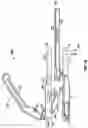 Fig. 17 - Minimally open interbody access retraction device and surgical method