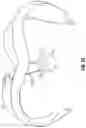 Fig. 20 - Minimally open interbody access retraction device and surgical method