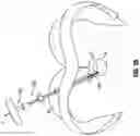 Fig. 24 - Minimally open interbody access retraction device and surgical method