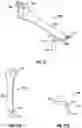 Fig. 25 - Minimally open interbody access retraction device and surgical method