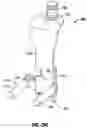 Fig. 28 - Minimally open interbody access retraction device and surgical method
