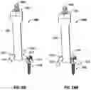 Fig. 34 - Minimally open interbody access retraction device and surgical method