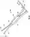 Fig. 40 - Minimally open interbody access retraction device and surgical method