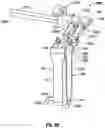 Fig. 42 - Minimally open interbody access retraction device and surgical method