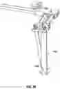 Fig. 46 - Minimally open interbody access retraction device and surgical method