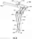 Fig. 48 - Minimally open interbody access retraction device and surgical method