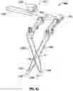 Fig. 49 - Minimally open interbody access retraction device and surgical method