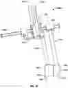Fig. 52 - Minimally open interbody access retraction device and surgical method