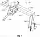 Fig. 53 - Minimally open interbody access retraction device and surgical method