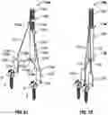 Fig. 56 - Minimally open interbody access retraction device and surgical method