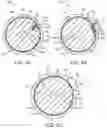 Fig. 05 - Elastic introducer sheath