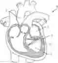 Fig. 01 - Transcatheter anchoring assembly for a mitral valve, a mitral valve, and related methods