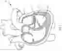 Fig. 02 - Transcatheter anchoring assembly for a mitral valve, a mitral valve, and related methods