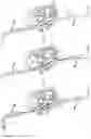 Fig. 24 - Transcatheter anchoring assembly for a mitral valve, a mitral valve, and related methods