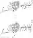 Fig. 25 - Transcatheter anchoring assembly for a mitral valve, a mitral valve, and related methods