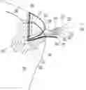 Fig. 01 - Suture anchor and method