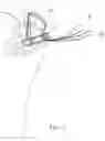 Fig. 10 - Suture anchor and method