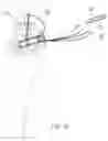 Fig. 11 - Suture anchor and method