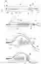 Fig. 15 - Suture anchor and method