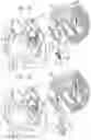 Fig. 03 - Helical anchor implantation