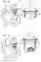 Fig. 07 - Helical anchor implantation